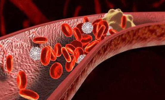 能軟化血管的12種食物 讓血管恢復正常