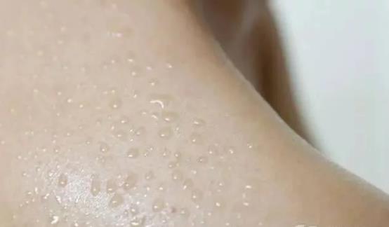 經常出汗也是病 4種疾病可引起多汗癥