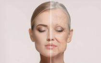 ?肌美人蔓越莓膠原蛋白肽，阻擊自然老化，恢復年輕體態