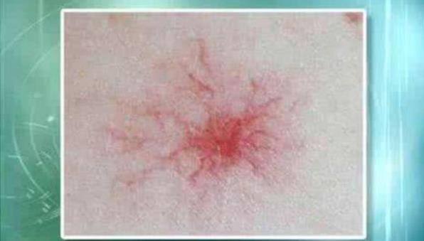 長期睡前玩手機的人,面部若有3癥狀,可能是肝在“吐槽”