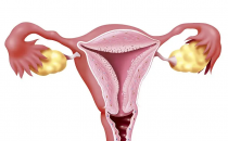 ?宮頸囊腫是怎么回事(宮頸囊腫是怎么回事需要治療嗎)