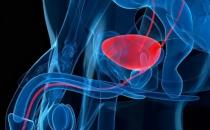 ?前列腺炎有什么癥狀和危害性，前列腺炎有什么癥狀和危害性吃什么食物